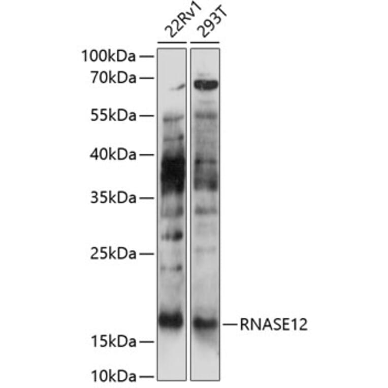 Western Blot - Anti-RNASE12 Antibody (A88522) - Antibodies.com