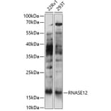 Western Blot - Anti-RNASE12 Antibody (A88522) - Antibodies.com