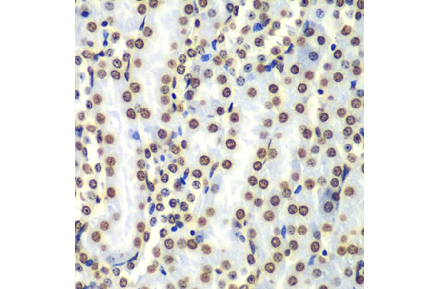 Chromatin Immunoprecipitation - Anti-Histone H3 Antibody (A88523) - Antibodies.com