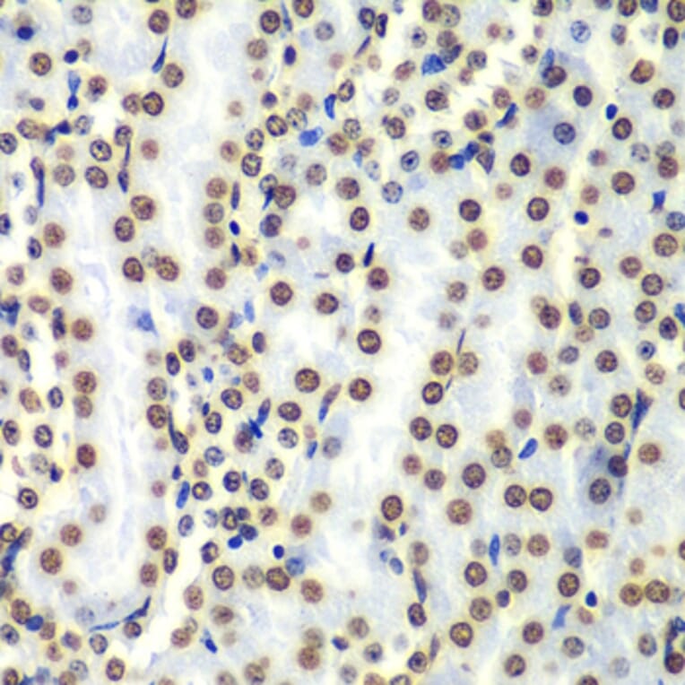 Chromatin Immunoprecipitation - Anti-Histone H3 Antibody (A88523) - Antibodies.com
