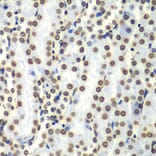 Chromatin Immunoprecipitation - Anti-Histone H3 Antibody (A88523) - Antibodies.com
