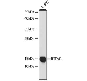Western Blot - Anti-IFITM1 Antibody (A88524) - Antibodies.com