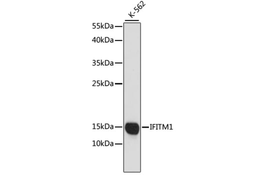 Western Blot - Anti-IFITM1 Antibody (A88524) - Antibodies.com