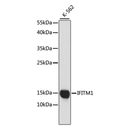 Western Blot - Anti-IFITM1 Antibody (A88524) - Antibodies.com