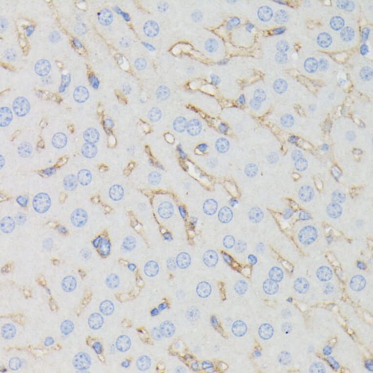 Immunohistochemistry - Anti-IFITM1 Antibody (A88524) - Antibodies.com