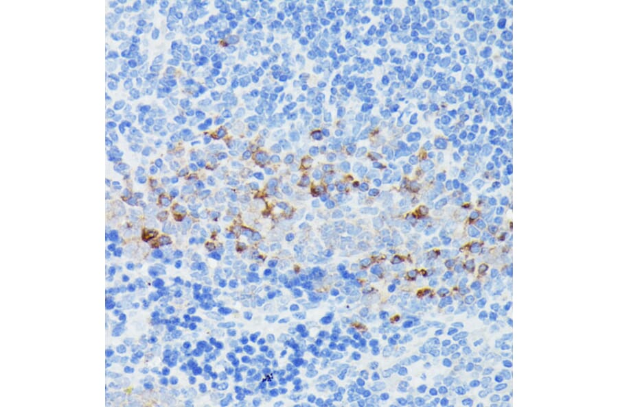 Immunohistochemistry - Anti-IFITM1 Antibody (A88524) - Antibodies.com