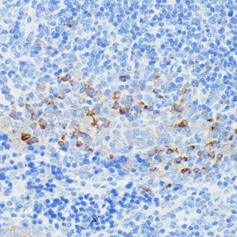 Immunohistochemistry - Anti-IFITM1 Antibody (A88524) - Antibodies.com