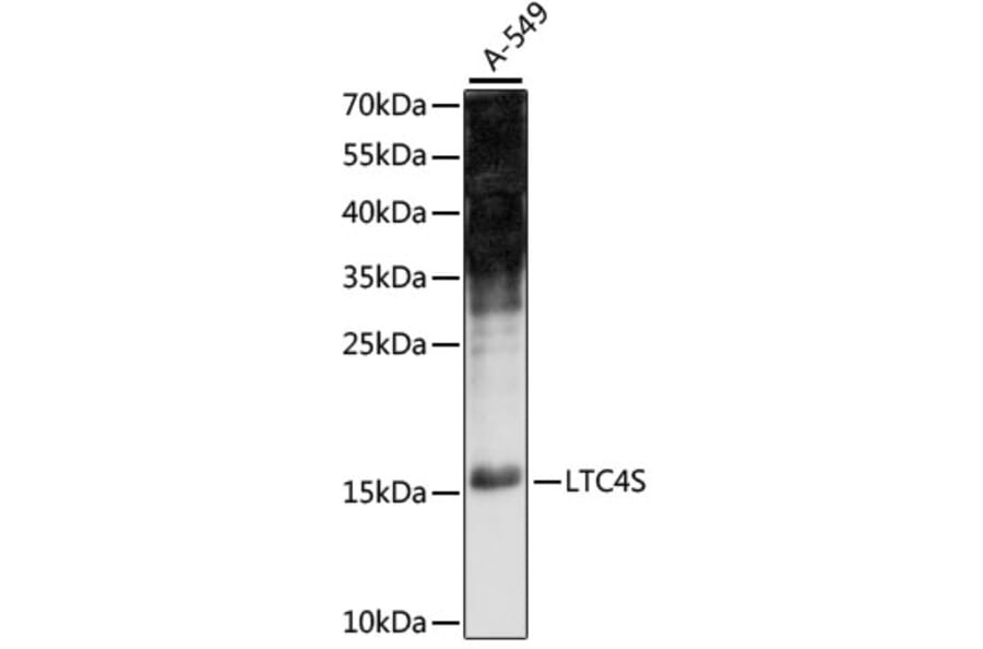 Western Blot - Anti-LTC4S Antibody (A88525) - Antibodies.com