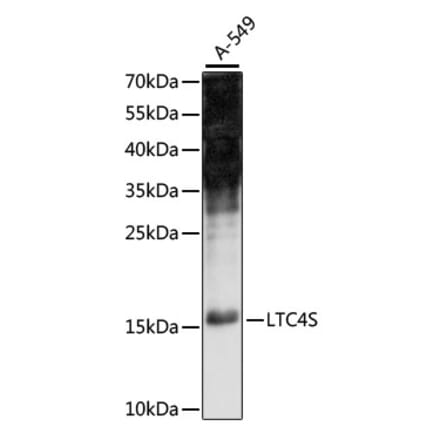 Western Blot - Anti-LTC4S Antibody (A88525) - Antibodies.com