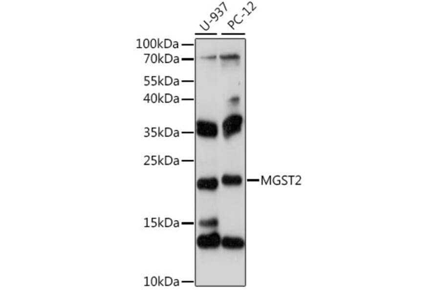 Western Blot - Anti-MGST2 Antibody (A88526) - Antibodies.com
