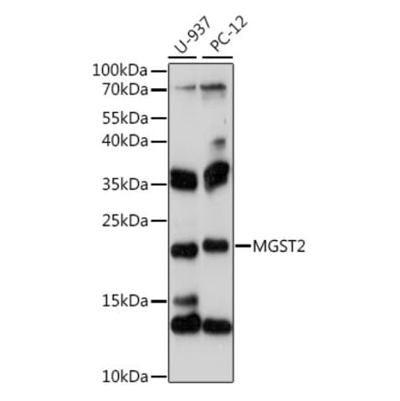 Western Blot - Anti-MGST2 Antibody (A88526) - Antibodies.com