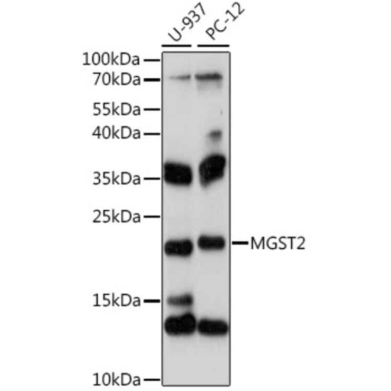 Western Blot - Anti-MGST2 Antibody (A88526) - Antibodies.com