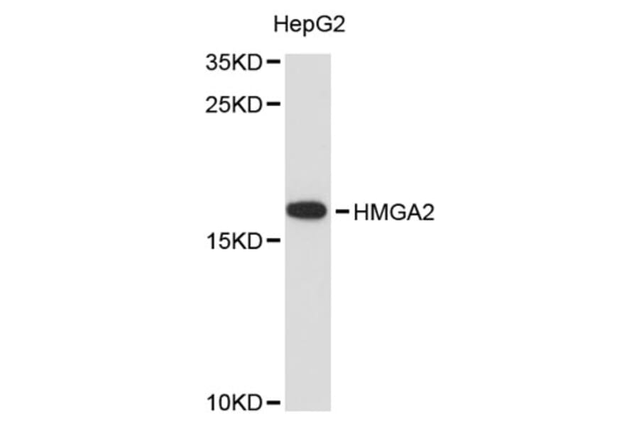 Western Blot - Anti-HMGA2 Antibody (A12743) - Antibodies.com