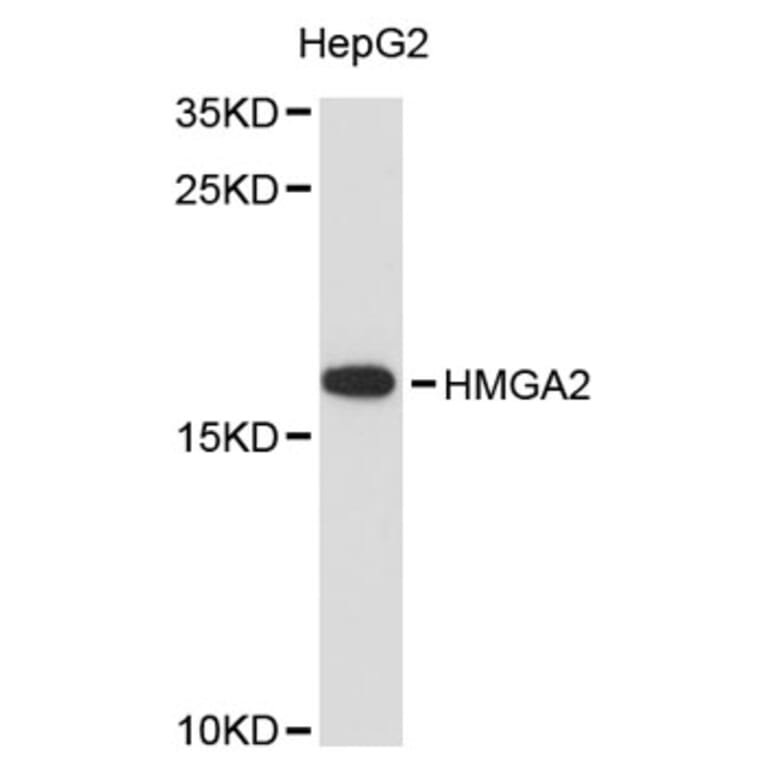 Western Blot - Anti-HMGA2 Antibody (A12743) - Antibodies.com