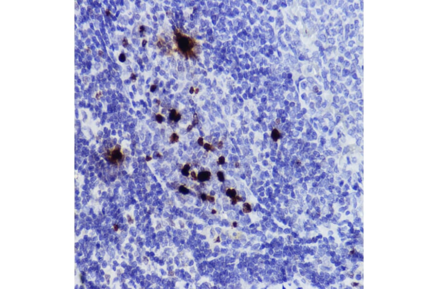 Immunohistochemistry - Anti-Histone H3 (phospho Ser10) Antibody (A88528) - Antibodies.com