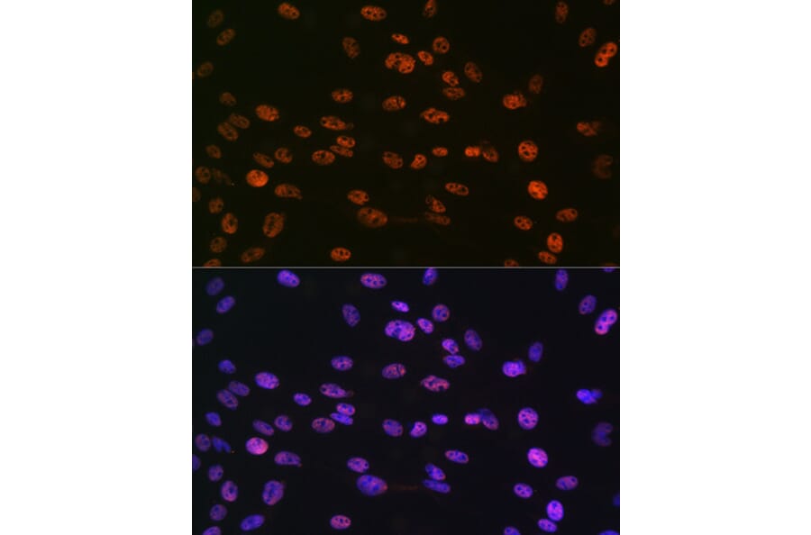 Immunofluorescence - Anti-Histone H3 (phospho Ser10) Antibody (A88528) - Antibodies.com