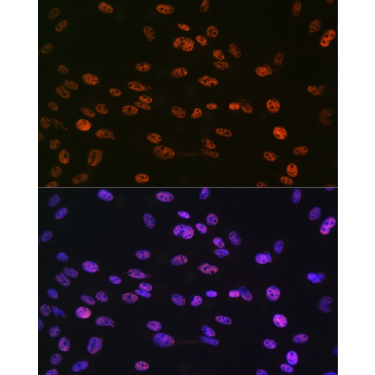 Immunofluorescence - Anti-Histone H3 (phospho Ser10) Antibody (A88528) - Antibodies.com