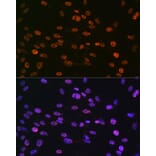 Immunofluorescence - Anti-Histone H3 (phospho Ser10) Antibody (A88528) - Antibodies.com
