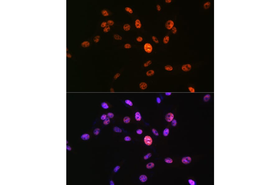 Immunofluorescence - Anti-Histone H3 (phospho Ser10) Antibody (A88528) - Antibodies.com