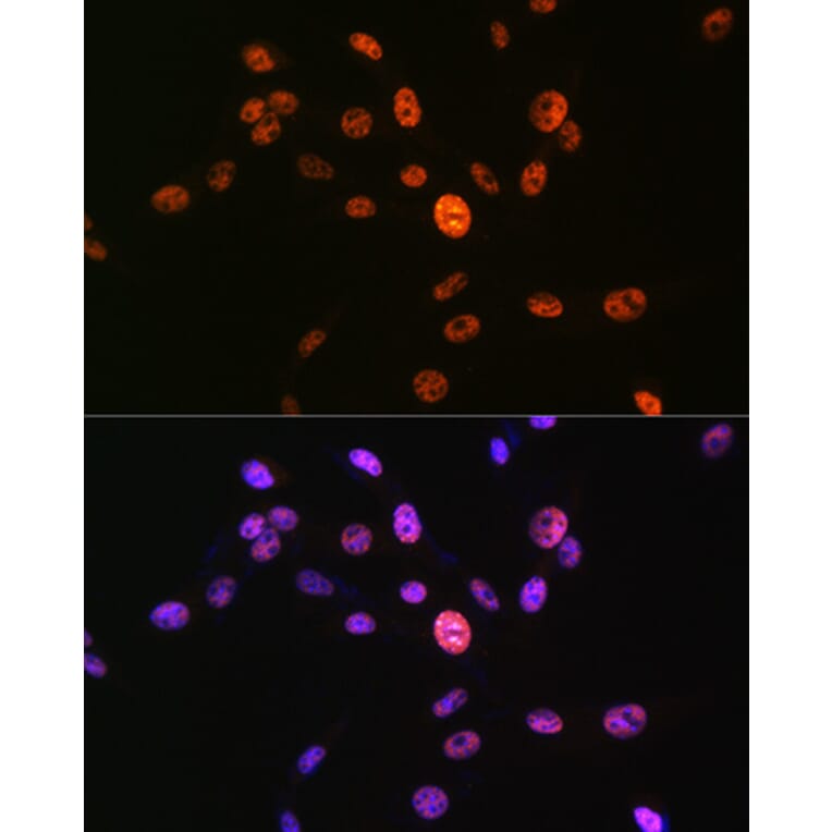 Immunofluorescence - Anti-Histone H3 (phospho Ser10) Antibody (A88528) - Antibodies.com