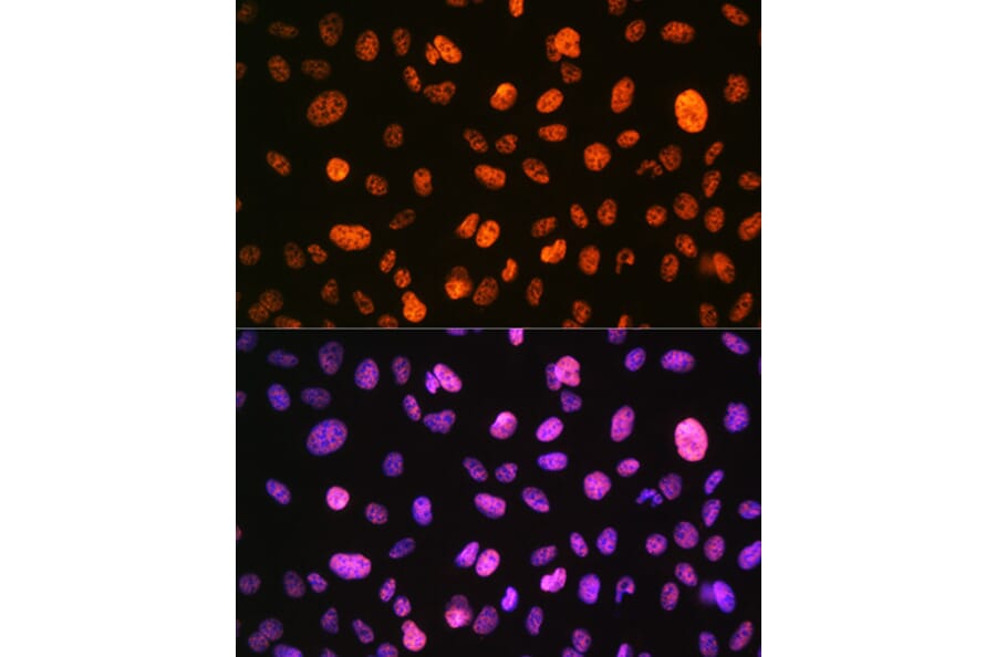 Immunofluorescence - Anti-Histone H3 (phospho Ser10) Antibody (A88528) - Antibodies.com