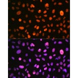 Immunofluorescence - Anti-Histone H3 (phospho Ser10) Antibody (A88528) - Antibodies.com