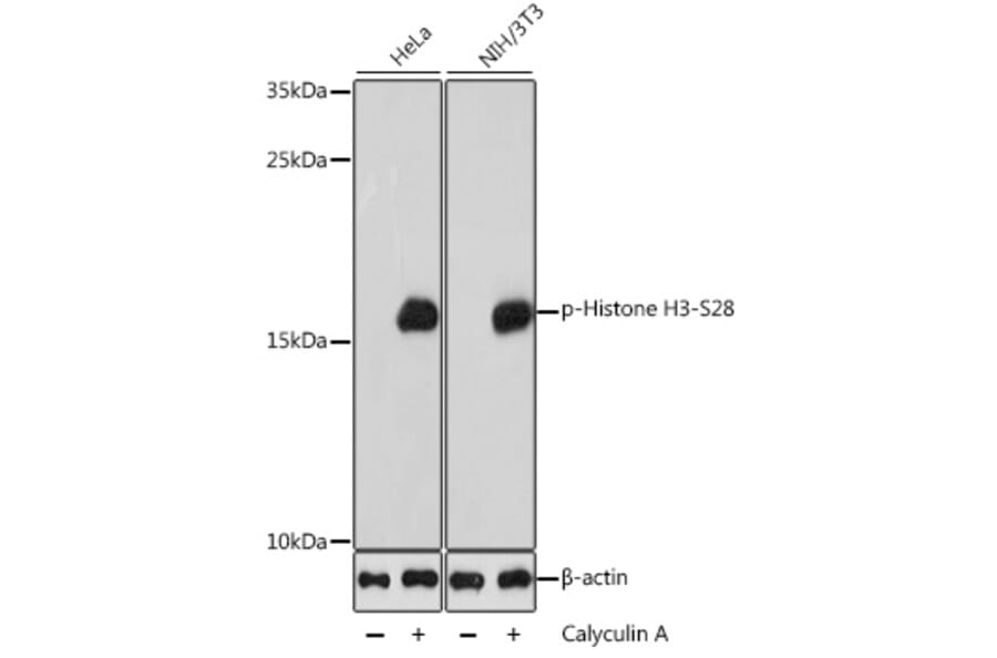 Western Blot - Anti-Histone H3 (phospho Ser28) Antibody (A88529) - Antibodies.com