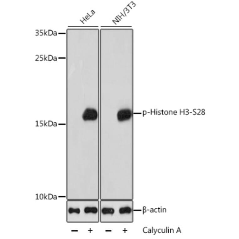 Western Blot - Anti-Histone H3 (phospho Ser28) Antibody (A88529) - Antibodies.com