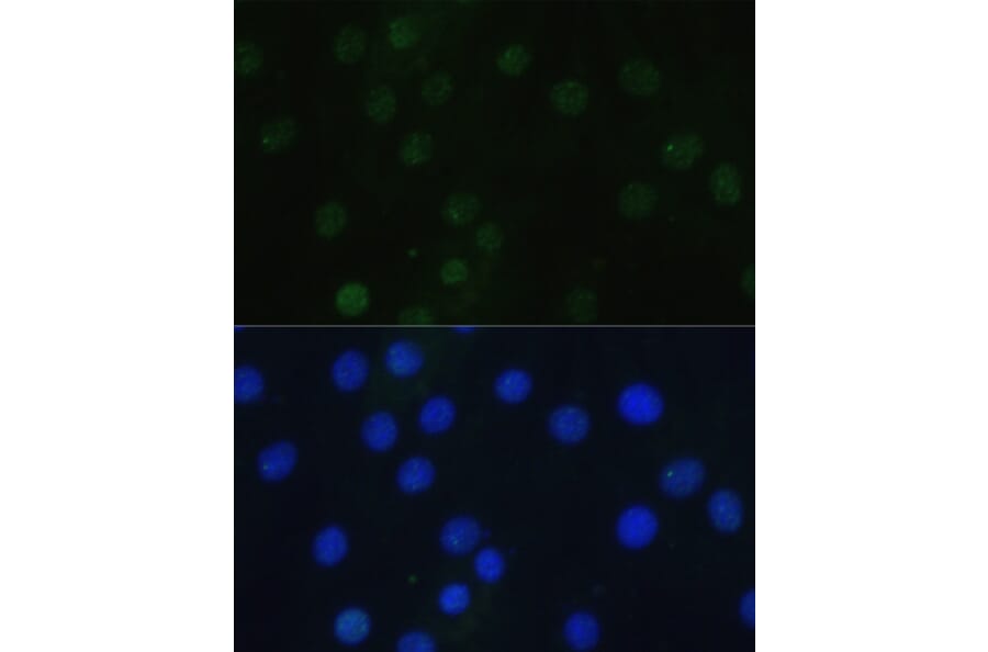 Immunofluorescence - Anti-Histone H3 (phospho Ser28) Antibody (A88529) - Antibodies.com