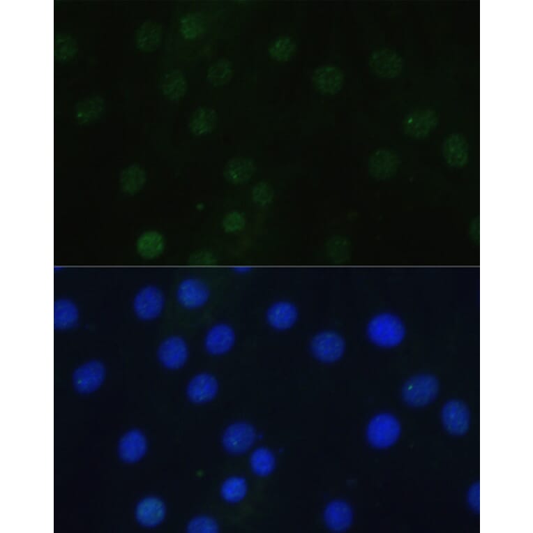Immunofluorescence - Anti-Histone H3 (phospho Ser28) Antibody (A88529) - Antibodies.com