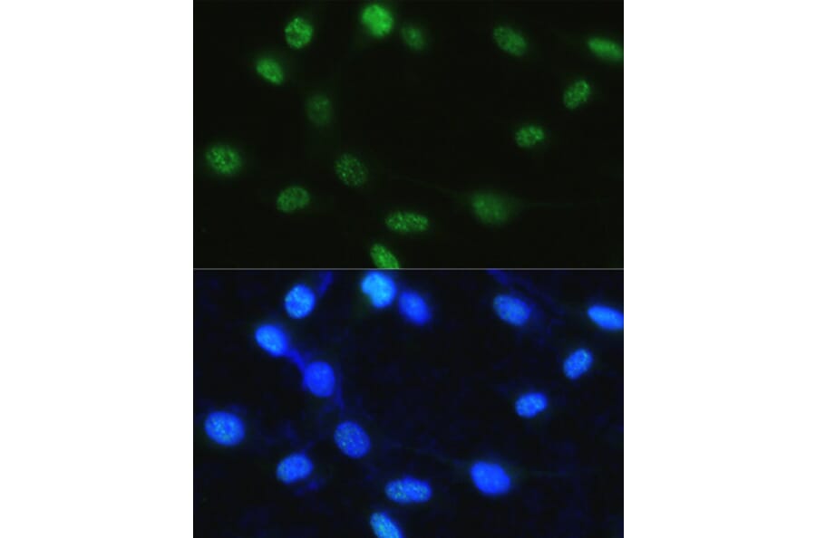 Immunofluorescence - Anti-Histone H3 (phospho Ser28) Antibody (A88529) - Antibodies.com