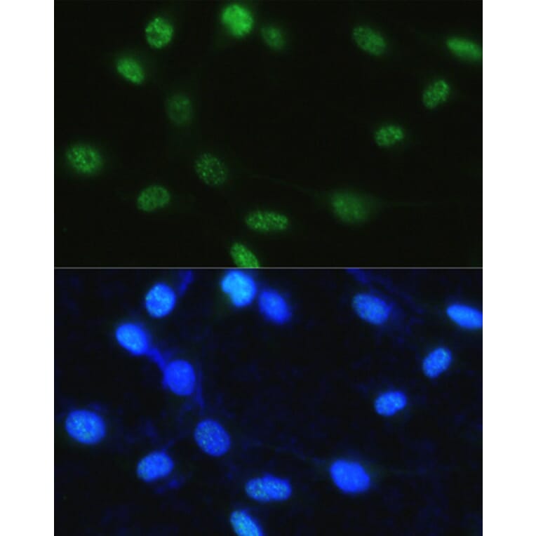 Immunofluorescence - Anti-Histone H3 (phospho Ser28) Antibody (A88529) - Antibodies.com