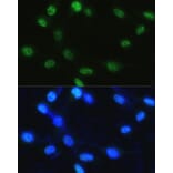 Immunofluorescence - Anti-Histone H3 (phospho Ser28) Antibody (A88529) - Antibodies.com