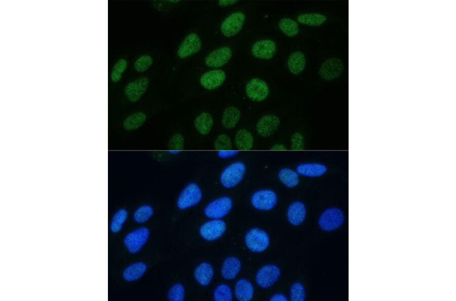 Immunofluorescence - Anti-Histone H3 (phospho Ser28) Antibody (A88529) - Antibodies.com