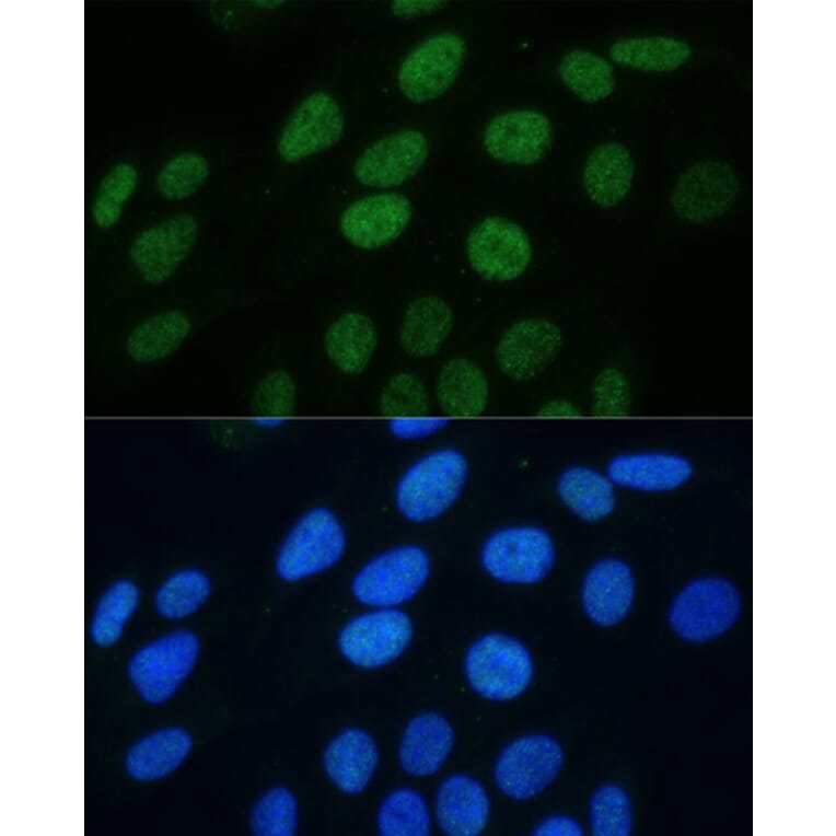 Immunofluorescence - Anti-Histone H3 (phospho Ser28) Antibody (A88529) - Antibodies.com