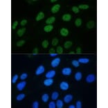 Immunofluorescence - Anti-Histone H3 (phospho Ser28) Antibody (A88529) - Antibodies.com