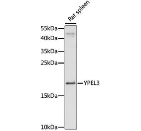 Western Blot - Anti-YPEL3 Antibody (A88531) - Antibodies.com