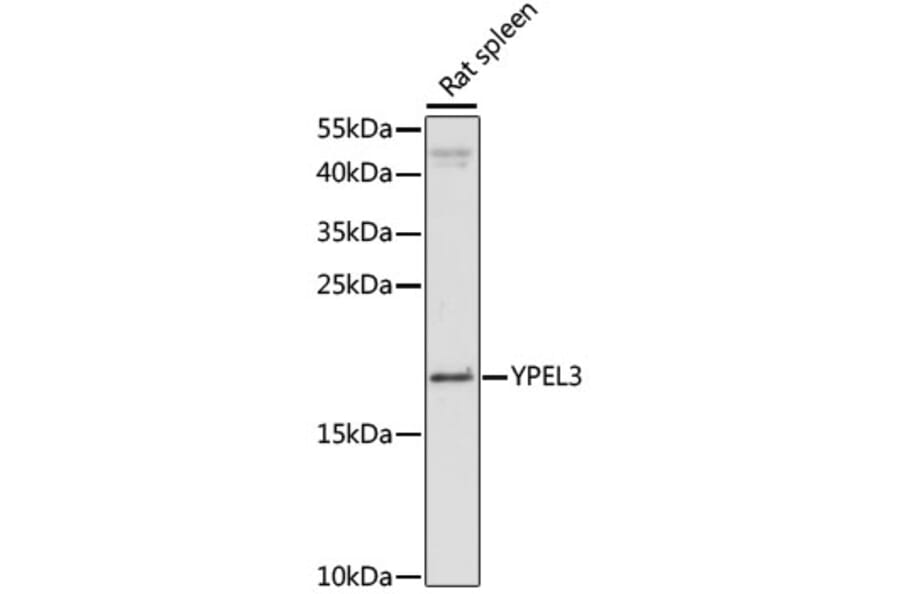 Western Blot - Anti-YPEL3 Antibody (A88531) - Antibodies.com