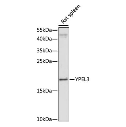 Western Blot - Anti-YPEL3 Antibody (A88531) - Antibodies.com
