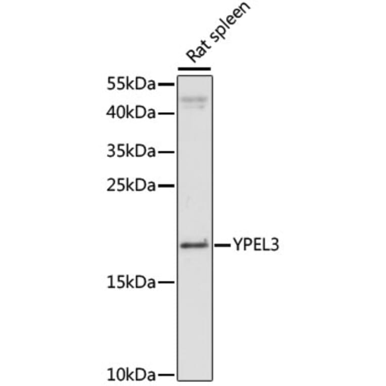 Western Blot - Anti-YPEL3 Antibody (A88531) - Antibodies.com