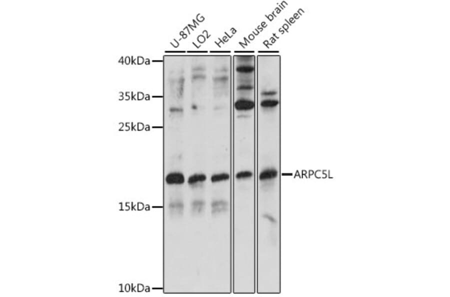 Western Blot - Anti-ARPC5L Antibody (A88532) - Antibodies.com