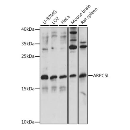 Western Blot - Anti-ARPC5L Antibody (A88532) - Antibodies.com