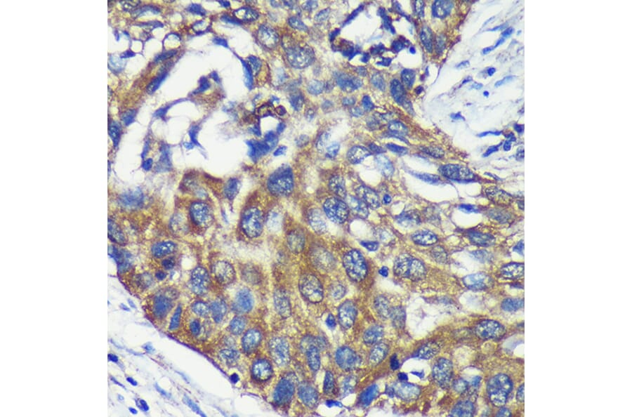 Immunohistochemistry - Anti-ARPC5L Antibody (A88532) - Antibodies.com