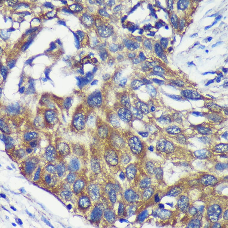 Immunohistochemistry - Anti-ARPC5L Antibody (A88532) - Antibodies.com