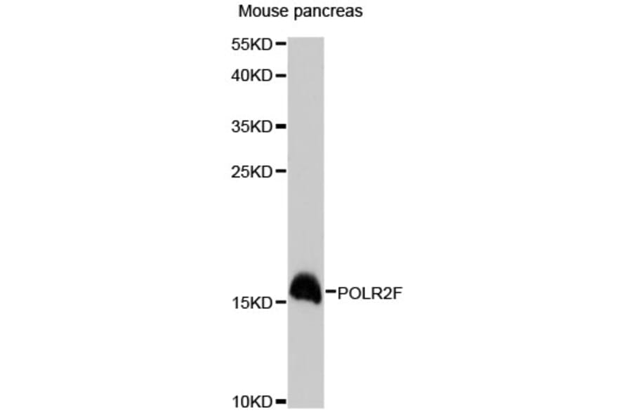 Western Blot - Anti-POLR2F Antibody (A13171) - Antibodies.com