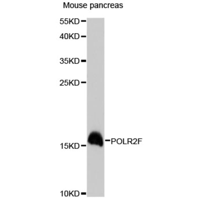 Western Blot - Anti-POLR2F Antibody (A13171) - Antibodies.com