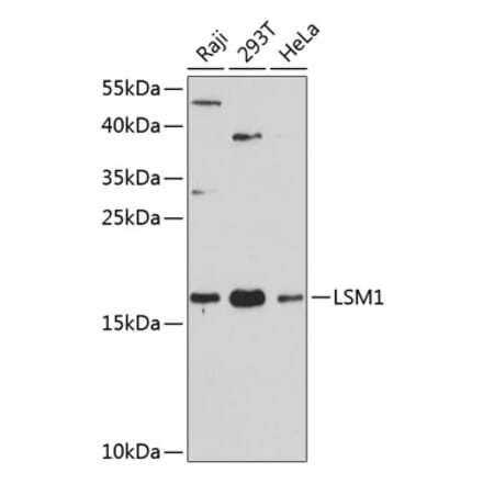 Western Blot - Anti-LSM1 Antibody (A88534) - Antibodies.com