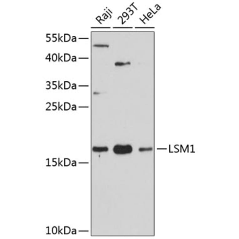 Western Blot - Anti-LSM1 Antibody (A88534) - Antibodies.com