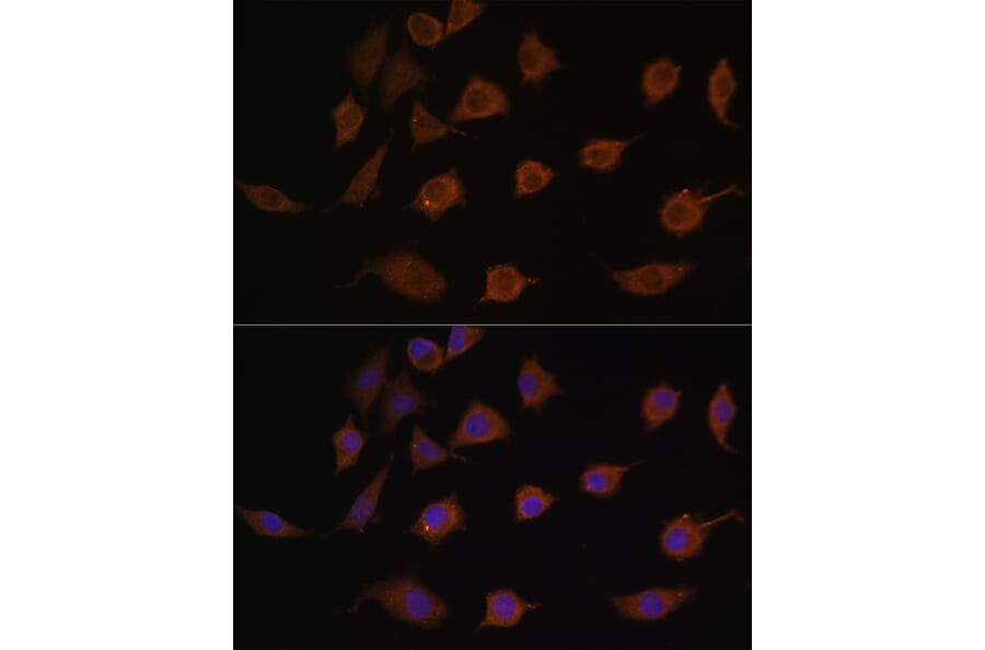 Immunofluorescence - Anti-LSM1 Antibody (A88534) - Antibodies.com