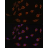 Immunofluorescence - Anti-LSM1 Antibody (A88534) - Antibodies.com